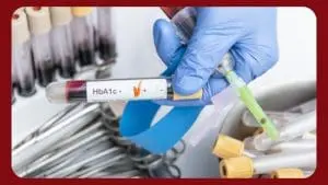 آزمایش قند خون سه ماهه چیست و چرا تجویز می‌شود؟